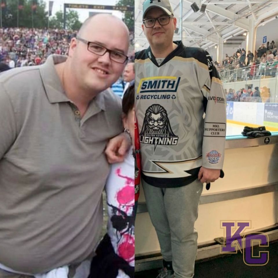 Before and after shot weight loss